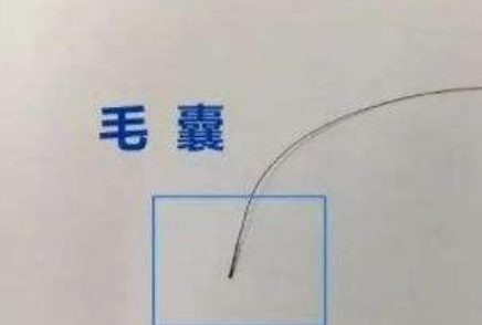 什么是親子判定？小梅與陳姑娘的故事