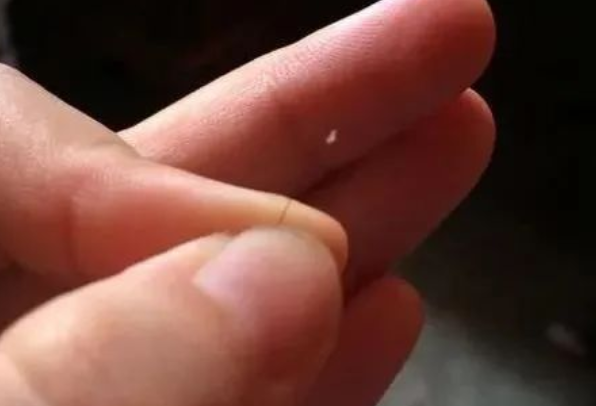 掉落的毛囊毛發(fā)可以拿去做染色體親子鑒定嗎？