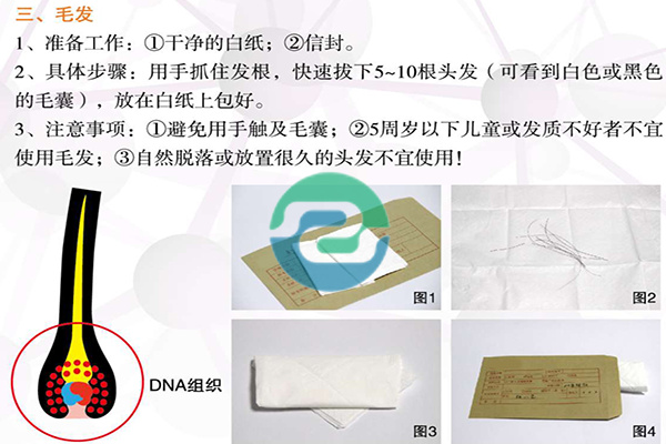 我們一定要用血嗎？我就不能偷偷拔根頭發行嗎？中山親子鑒定樣本解答